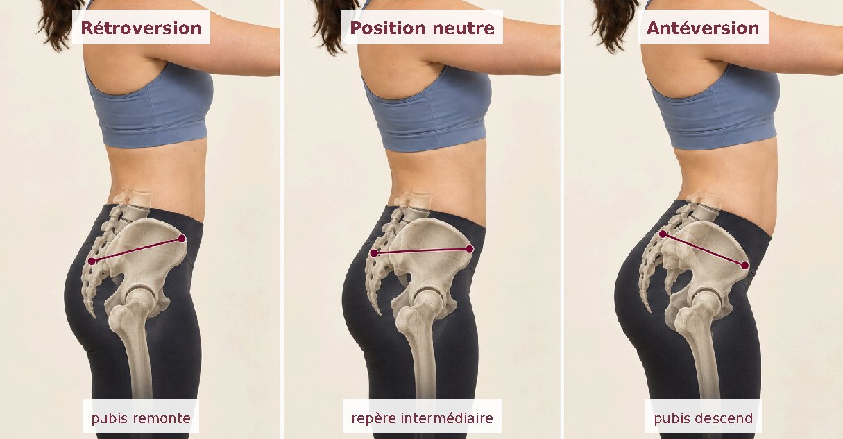 Schéma 1 — Rétroversion, position neutre et antéversion du bassin (vue de profil)